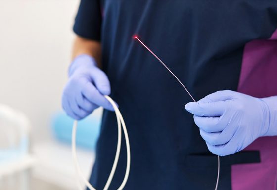 Endovenous Thermal Ablation